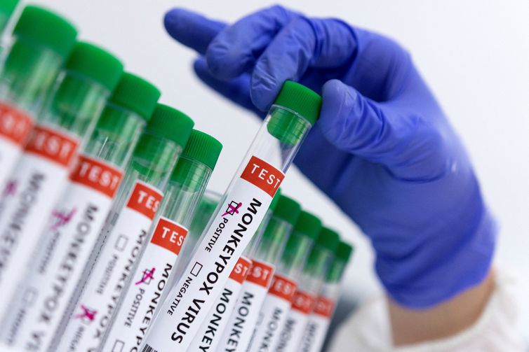 Confirmados três casos de “varíola do macaco” em Aracaju